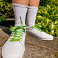 White sneakers with green and yellow pickle laces worn by a person on a concrete surface with greenery in the background.