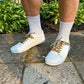White sneakers with leopard print shoelaces worn on a stone pavement with greenery in the background