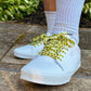 White sneakers with yellow duck themed shoelaces worn with light gray socks on a concrete surface.